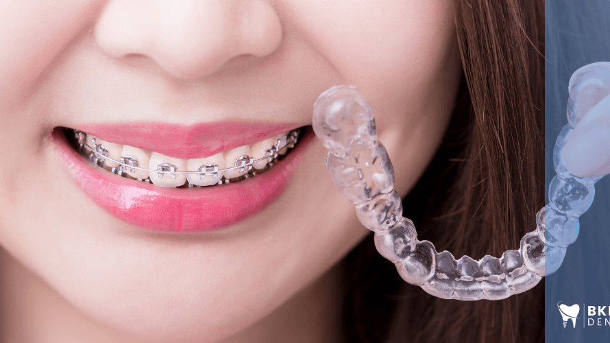 Orthodontie et appareils dentaires : ce qu’il faut savoir